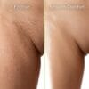 alo intima friction vs smooth skin comparison visual alo intima friction vs smooth skin comparison visual